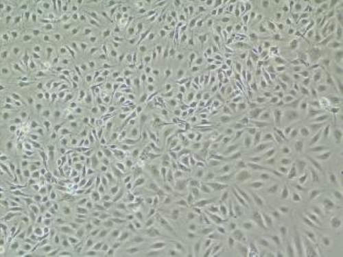 肝窦内皮细胞(Liver Endothelial Cells, LECs)