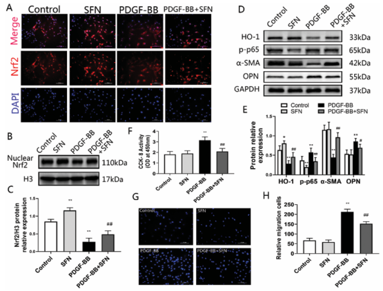 图 Activating the Nrf2 pathway by SFN inhibited PDGF-BB-induced proliferation, migration and phenotypic switching in VSMCs. 