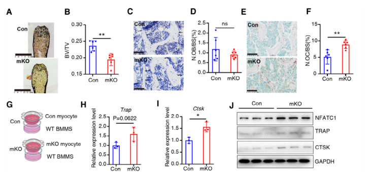 图 Skeletal muscle Bmal1 deficiency promotes osteoclast differentiation.