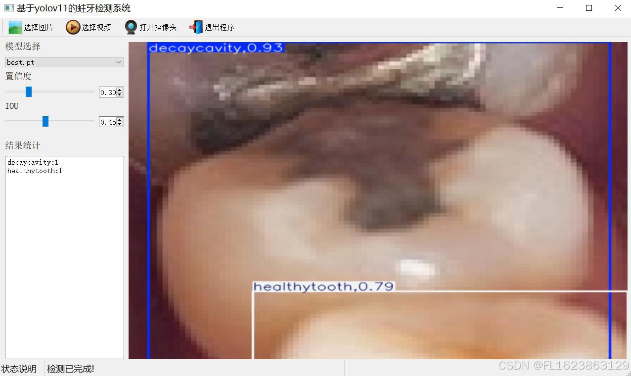 基于yolov11的蛀牙检测系统python源码+pytorch模型+评估指标曲线+精美GUI界面
