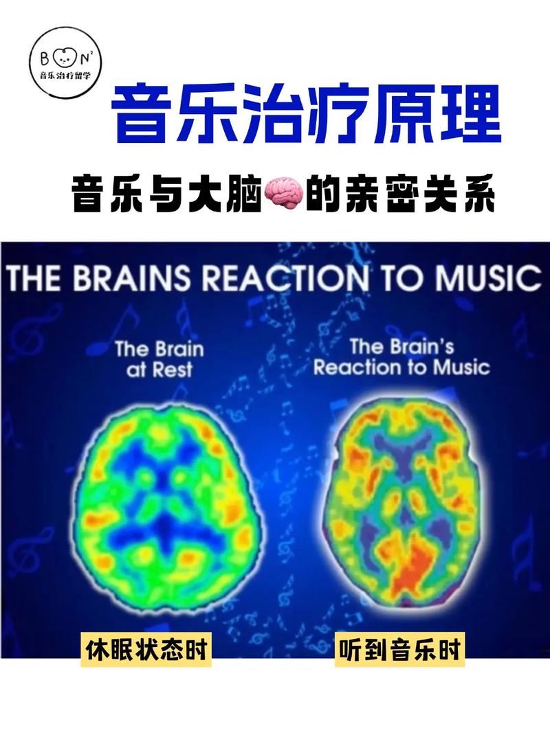 音乐认知训练,促进神经系统重塑