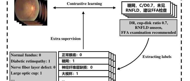 ViLReF:一种汉语视觉语言视网膜基础模型 !