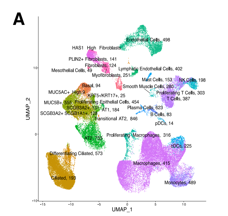 基于 scRNA-seq 数据构建 IPF 细胞类型特异性疾病特征的策略示意,分别针对 MUC5B⁺ 上皮细胞和肌成纤维细胞提取差异表达基因特征。