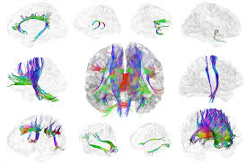 BrainVoyager