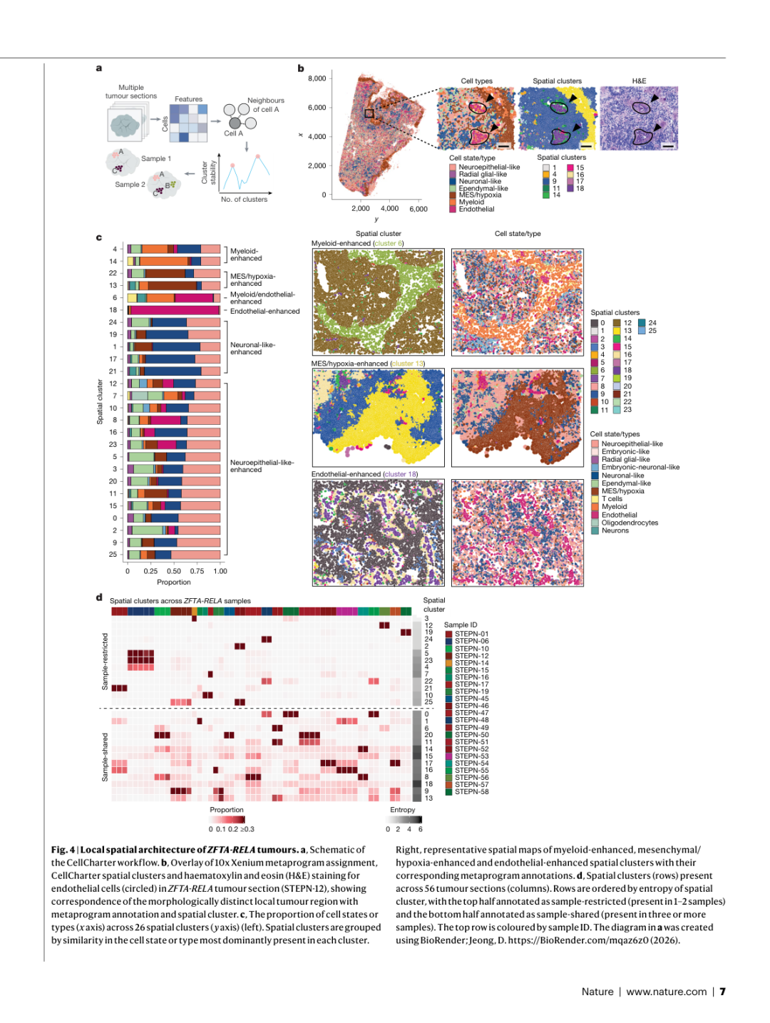 Figure 4: ZFTA-RELA肿瘤的局部空间架构