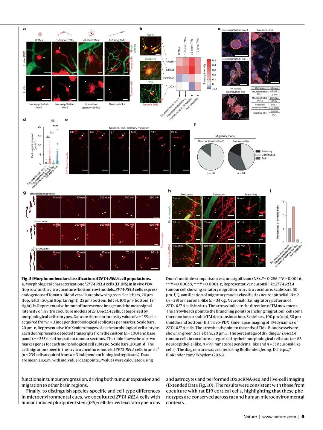 Figure 5: ZFTA-RELA细胞群的形态-分子分类
