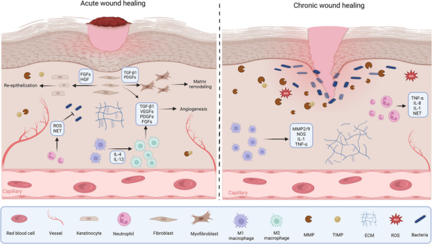 Cytokine-and-growth-factor-signaling-in-acute-and-chronic-wound-healing-Figure-prepared