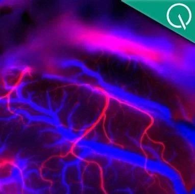 马斯克：Neuralink首个人体植入手术完成！已探测到神经信号，患者恢复良好