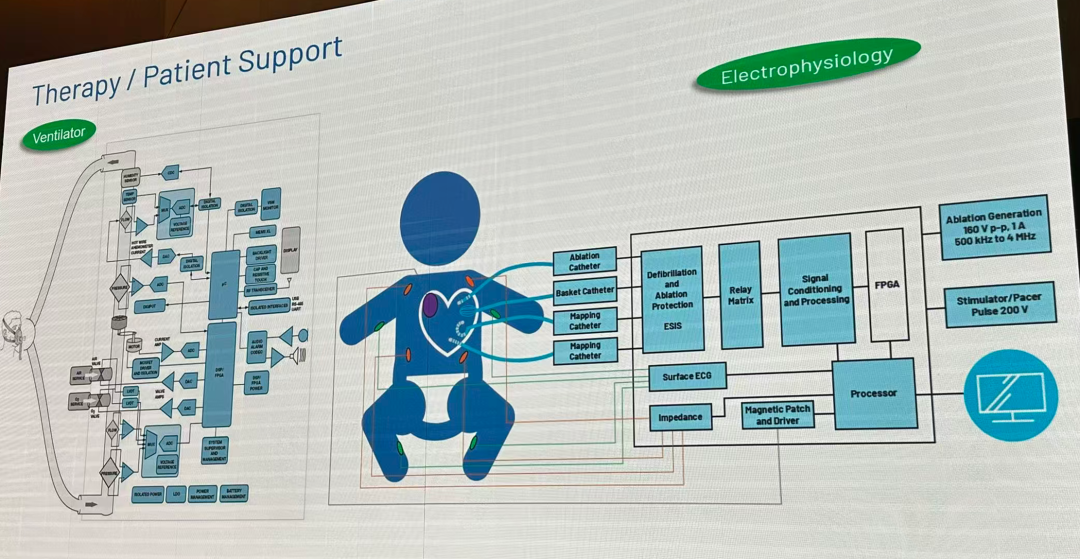 这个是体外生命维持系统