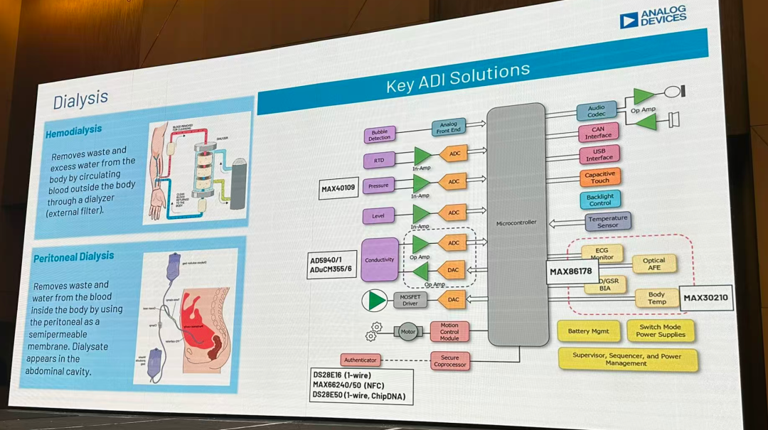 这个是体外的透析