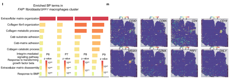 fap fibroblasts 和 spp1 macrophages空間分佈