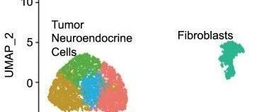 单细胞RNA测序（scRNA-seq）揭示了小肠神经内分泌癌患者肝转移瘤特异性的治疗靶点