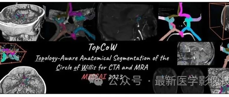 Top_Cow 2023——CTA和MRA的Willis环血管拓扑解剖结构分割解决方案分享