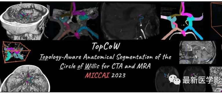 Top_Cow 2023——用于CTA和MRA的Willis环的拓扑解剖结构分割docker推理部署