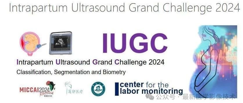 IUGC2024——产时超声检查挑战赛