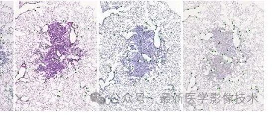 ANHIR2019——自动非刚性组织学图像配准之传统非刚性配准方法
