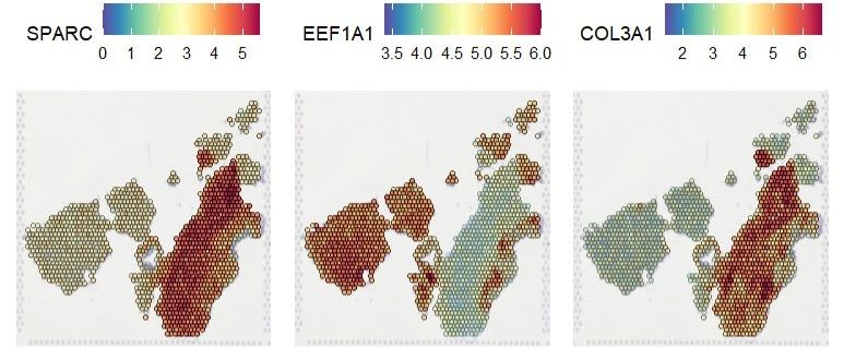 空间转录组|Load10X_Spatial函数修改适配多形式数据 + 空转标准流程