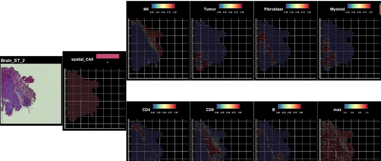 空转 | 结合scRNA完成空转spot注释（Seurat Mapping） &  彩蛋（封面的空转主图代码）