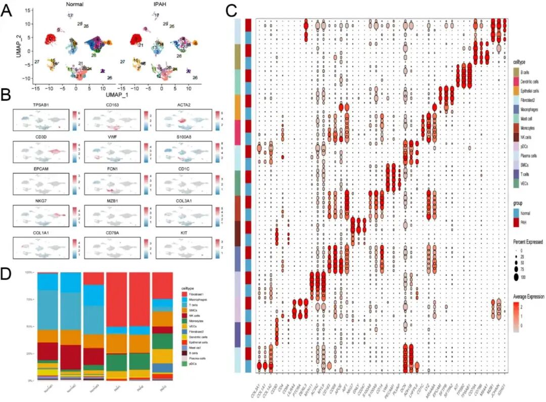 从IPAH患者肺组织中获得的单细胞RNA测序数据的转录组谱