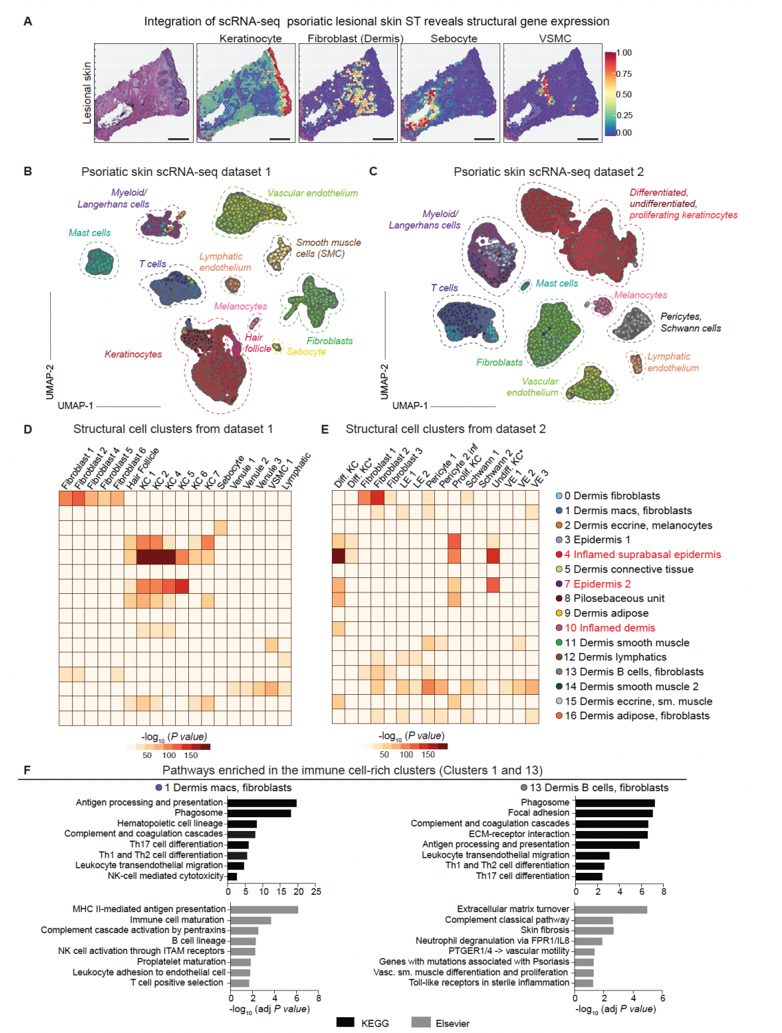 Spatial  plots, UMAP of psoriatic skin cell types, and MIA from publicly sourced  RNA seq data and pathways enriched in the immune cell-dense clusters